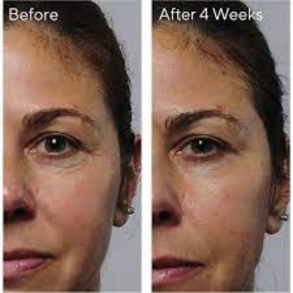 Murad Rapid Collagen Infusion - Picture 3 of 3